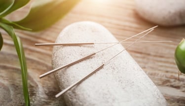 les aiguilles d'acupuncture