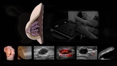 Image of breast ultrasound being performed.