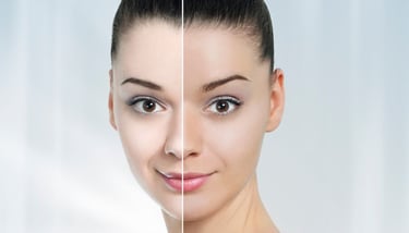 Bleach and de-tan treatments for brighter, even-looking skin
