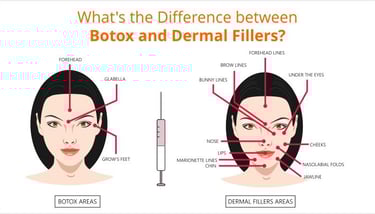 botox vs dermal fillers