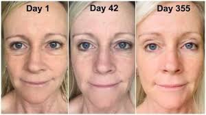 Before and after of woman aging younger after 355 days