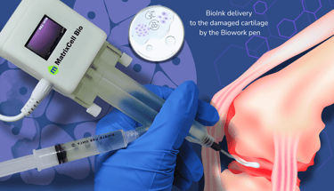 Bioprinting pen application for damaged cartilage repair