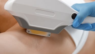IPL SHR Hair removal singapore