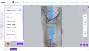 BenX digital orthotics and prosthetics system