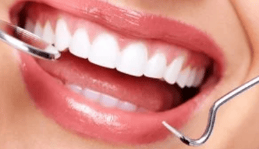 كشف دوري لفحص الفم والأسنان