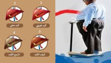 السمنة عامل الخطر الاكبر