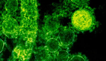 Close up of a virus through a microscope