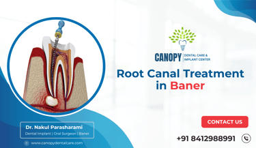 Root Canal Treatment in Baner