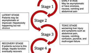 stages
