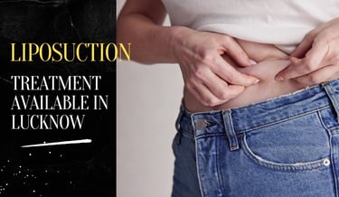 Liposuction in Lucknow