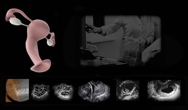 Panel of transvaginal ultrasound images from our hands-on training course.