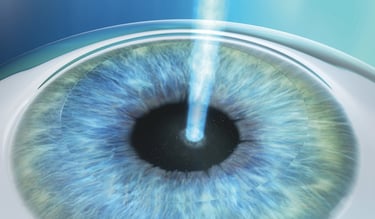 Antalyada lazer göz tedavisi en iyi doktor kimdir?