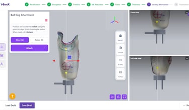 BenX custom prosthetic socket design platform