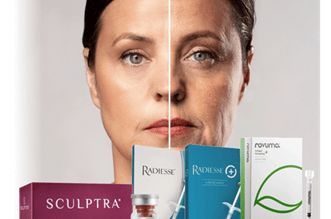 radiesee, bioestimuladores