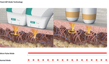 Ultraformer MPT HIFU Singapore Clinic