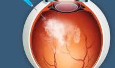 Retinitis Pigmentosa Fasting, Autophagy, Stem Cells, and Emerging Therapies