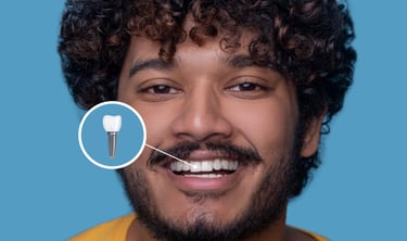 A smiling man showcasing the results of a dental implant procedure with a tooth diagram overlay.
