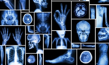 Radiologie à domicile