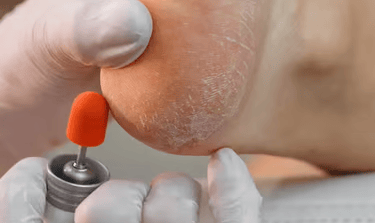 Podóloga em Aparecida de Goiânia