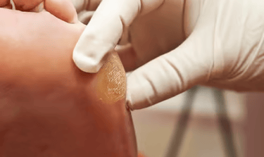 Podóloga em Aparecida de Goiânia