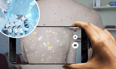 ai tool detect skin cancerimage by medtech blog