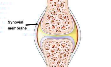 Dr.Rajinikanth's ortho clinic synovitis