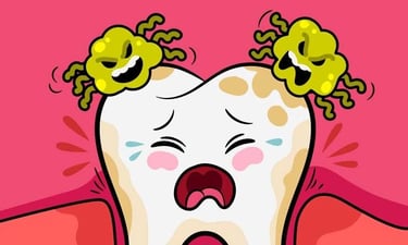 Surinfection dentaire hygiene-precision.com