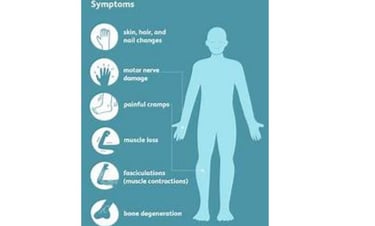 neuropathy symptoms