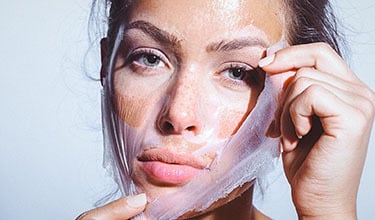 peelinguri chimice Timisoara