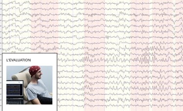 extrait de tracé EEG