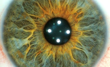 picture of green iris