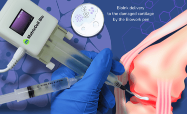 Bioprinting pen application for damaged cartilage repair