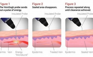 Veingogh by Dr. Omar Hamdallah