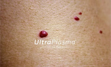 _ultra_plasma_ultra_plazma_ultra-plasma_ultra-plazma