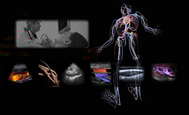 Image showing vascular anatomy and various images of ultrasound vascular imaging and Doppler.