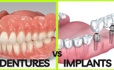 an image showing comparison between dentures and dental implants