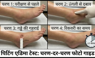 finger pressing on ankle showing pitting edema test, with depth measurement and recovery time