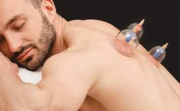 Male relaxed and happy receiving cupping on his back
