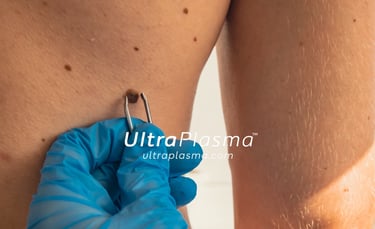 ma_ultra_plazma_examin-ng_skin_cilt_analiz_disorder_analysis_dermatologist