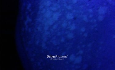 ma_ultra_plazma_examin-ng_skin_cilt_analiz_disorder_analysis_dermatologist