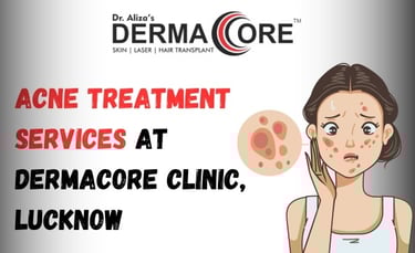 acne treatment dermacore lucknow