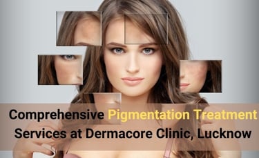 pigmentation treatment