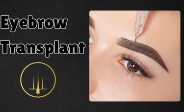 Eyebrow Transplant