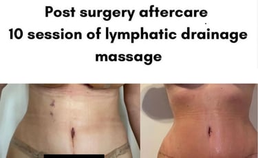 Manual lymphatic Drainage 