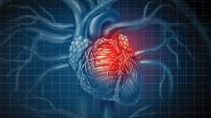 Coronary Heart Diseases