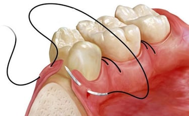 chirurgie orala si maxilofaciala Timisoara