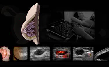 Image showing breast anatomy with various ultrasound images with and with and without Doppler.