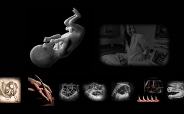 Image of a human fetus and various obstetric ultrasound images with and without Doppler.