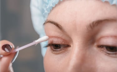 blefaroplastica non chirurgica trento rovereto verona bolzano