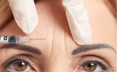 botox medicina estetica a Rovereto, vicino a Trento, Bolzano, Verona